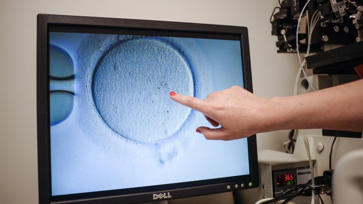 An embryologist shows an Ovocyte after it was inseminated at the Virginia Center for Reproductive Medicine, in Reston, Virginia on June 12, 2019