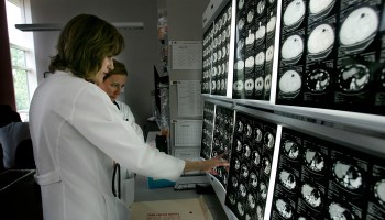 Two women doctors review PET scans at John Hopkins hospital in Maryland