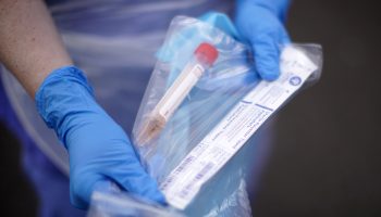 A doctor holds a test tube in a clear bag.