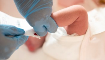 Photo of a physician taking a blood sample from a newborn infant.
