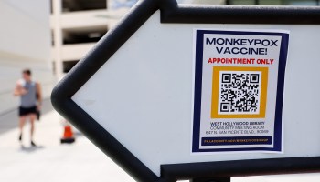 A sign directs people toward a pop-up monkeypox vaccination clinic in West Hollywood, California.