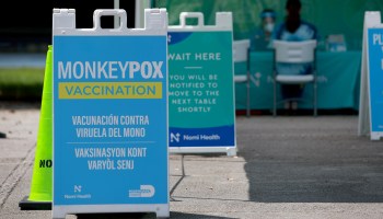 A sign announcing monkeypox vaccination is setup in Tropical Park by Miami-Dade County and Nomi Health on August 15, 2022 in Miami, Florida.